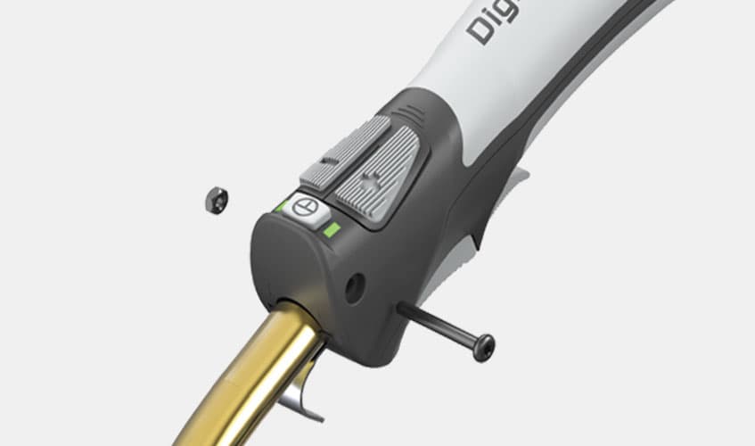 Digital MIG Controls